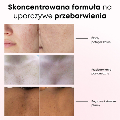 Lumen Drop – Serum przeciw przebarwieniom i korekcji pigmentacji