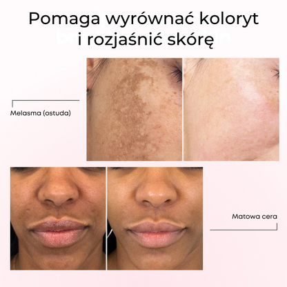 Lumen Drop – Serum przeciw przebarwieniom i korekcji pigmentacji