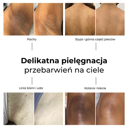 Lumen Drop – Serum przeciw przebarwieniom i korekcji pigmentacji