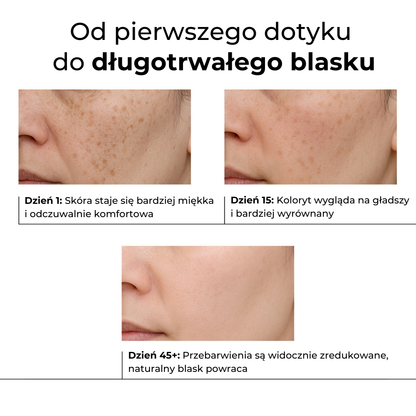 Lumen Drop – Serum przeciw przebarwieniom i korekcji pigmentacji
